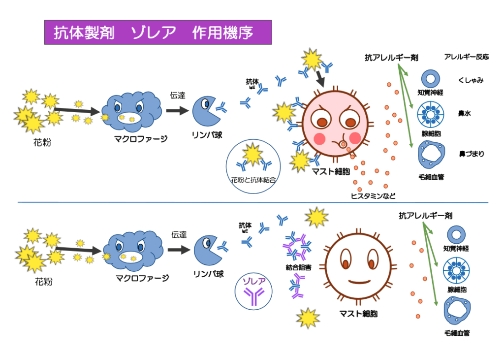 じんましん（蕁麻疹）にはゾレア